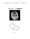 BRAIN VOLUMETRIC MEASURING METHOD AND SYSTEM USING THE SAME diagram and image