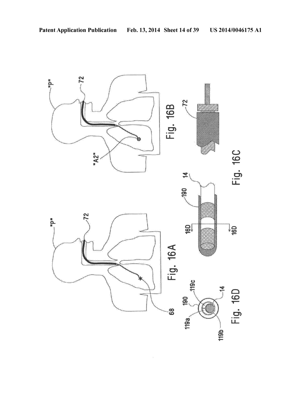 MICROWAVE ABLATION CATHETER AND METHOD OF UTILIZING THE SAME - diagram, schematic, and image 15