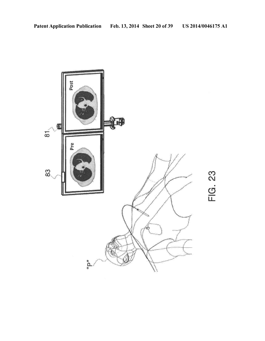 MICROWAVE ABLATION CATHETER AND METHOD OF UTILIZING THE SAME - diagram, schematic, and image 21