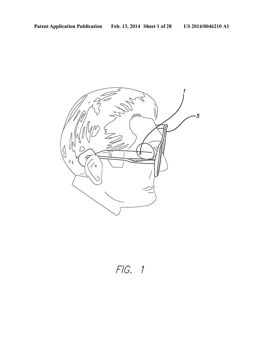 Field of View Matching in a Visual Prosthesis - diagram, schematic, and image 02