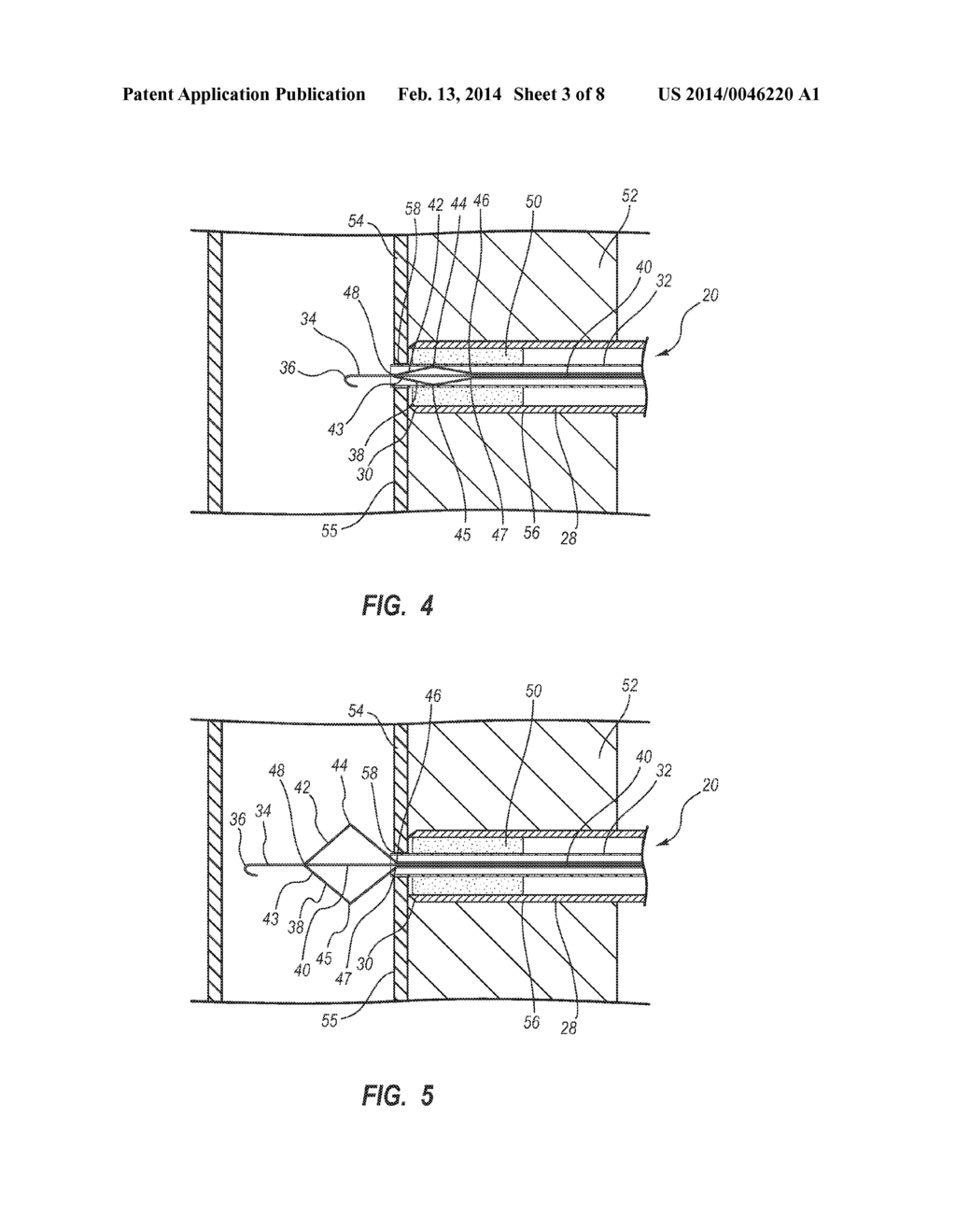 METHOD AND DEVICE FOR LOCATING A VESSEL AND FOR CLOSING A VASCULAR     PUNCTURE SITE - diagram, schematic, and image 04