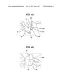 INTEGRATED DRESSING DEVICE diagram and image