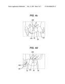 INTEGRATED DRESSING DEVICE diagram and image