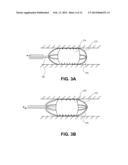 Methods and Devices for Eluting Agents to a Vessel diagram and image