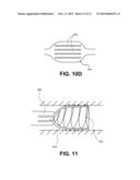 Methods and Devices for Eluting Agents to a Vessel diagram and image