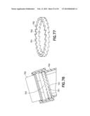 Multiple Use Disposable Injection Pen diagram and image