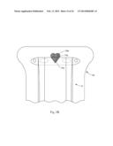 INSERT WITH ADVANTAGEOUS FASTENER CONFIGURATIONS AND END STIFFNESS     CHARACTERISTICS FOR TWO-PIECE WEARABLE ABSORBENT ARTICLE diagram and image