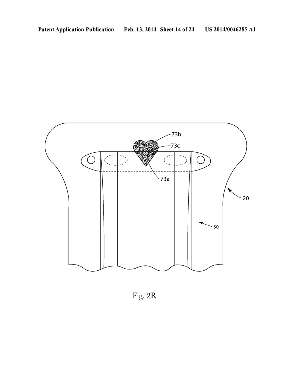 INSERT WITH ADVANTAGEOUS FASTENER CONFIGURATIONS AND END STIFFNESS     CHARACTERISTICS FOR TWO-PIECE WEARABLE ABSORBENT ARTICLE - diagram, schematic, and image 15