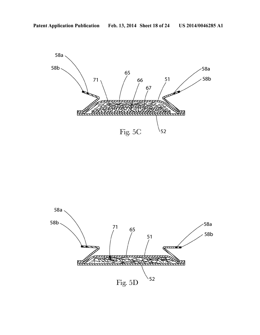 INSERT WITH ADVANTAGEOUS FASTENER CONFIGURATIONS AND END STIFFNESS     CHARACTERISTICS FOR TWO-PIECE WEARABLE ABSORBENT ARTICLE - diagram, schematic, and image 19