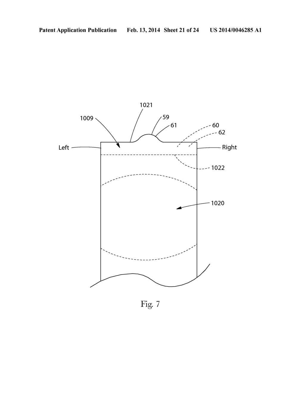 INSERT WITH ADVANTAGEOUS FASTENER CONFIGURATIONS AND END STIFFNESS     CHARACTERISTICS FOR TWO-PIECE WEARABLE ABSORBENT ARTICLE - diagram, schematic, and image 22