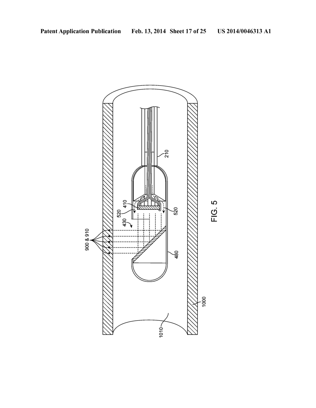 TISSUE NECROSIS METHODS AND APPARATUS - diagram, schematic, and image 18