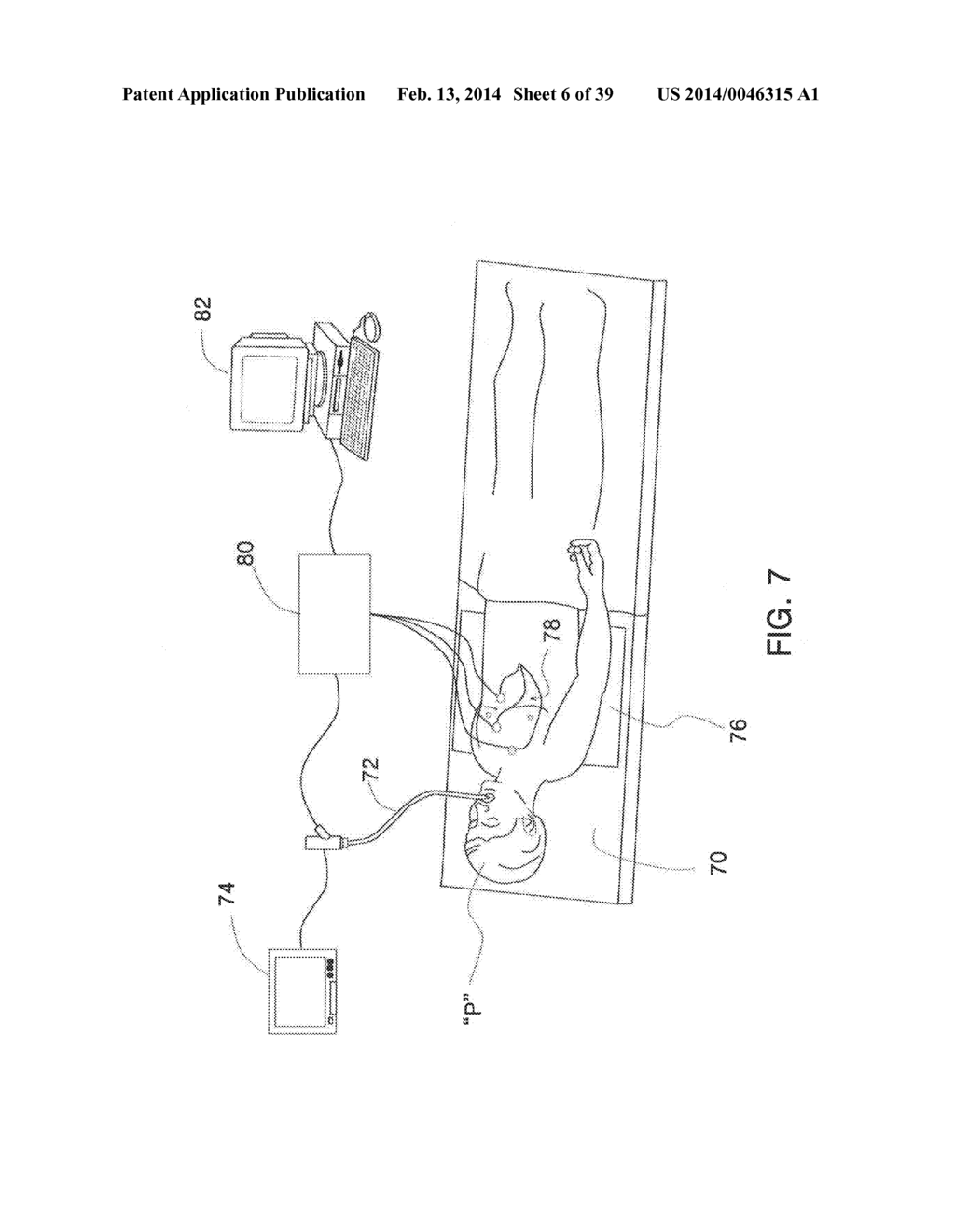 MICROWAVE ABLATION CATHETER AND METHOD OF UTILIZING THE SAME - diagram, schematic, and image 07