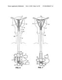 Moisture Transport System for Contact Electrocoagulation diagram and image