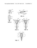 Moisture Transport System for Contact Electrocoagulation diagram and image