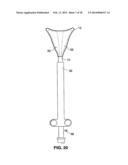 Moisture Transport System for Contact Electrocoagulation diagram and image