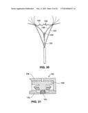 Moisture Transport System for Contact Electrocoagulation diagram and image