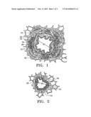 METHODS OF TREATING A LUNG diagram and image