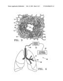 METHODS OF TREATING A LUNG diagram and image