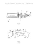 METHODS OF TREATING A LUNG diagram and image