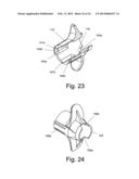 Intraosseous Device For Inserting A Cannula Into A Bone diagram and image