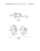 EQUIPMENT FOR INSERTING A JOINT PROSTHESIS, IN PARTICULAR A KNEE     PROSTHESIS diagram and image