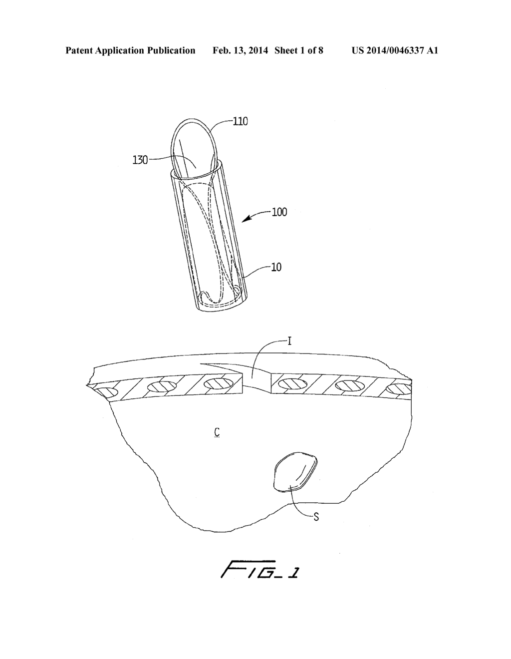 SURGICAL RETRIEVAL APPARATUS - diagram, schematic, and image 02