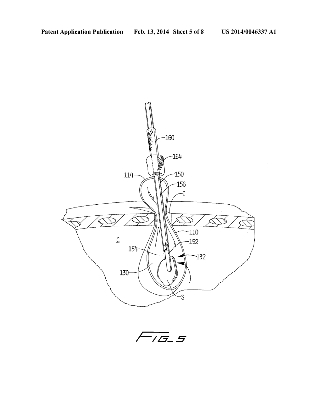 SURGICAL RETRIEVAL APPARATUS - diagram, schematic, and image 06