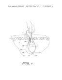 SURGICAL RETRIEVAL APPARATUS diagram and image