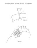 ACOUSTIC THERAPY DEVICE diagram and image