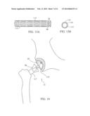 ACOUSTIC THERAPY DEVICE diagram and image