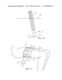 ACOUSTIC THERAPY DEVICE diagram and image