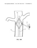 DEVICES, SYSTEMS AND METHODS FOR ENGAGING TISSUE diagram and image