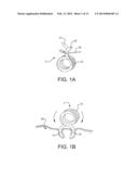 Microanchors for Anchoring Devices to Body Tissues diagram and image