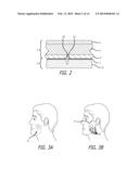 Tissue Attachment Device And Method diagram and image