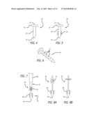 Tissue Attachment Device And Method diagram and image