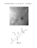 Tissue Attachment Device And Method diagram and image