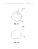 Devices and Methods for Securing Medical Devices within an Anatomy diagram and image