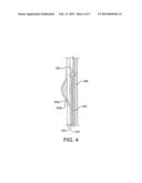 Devices and Methods for Securing Medical Devices within an Anatomy diagram and image