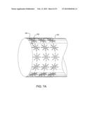 Devices and Methods for Securing Medical Devices within an Anatomy diagram and image