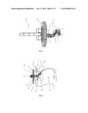 Orthodontic Comforter diagram and image