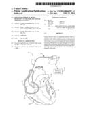 IMPLANTABLE MEDICAL DEVICE RESPONSIVE TO MRI INDUCED CAPTURE THRESHOLD     CHANGES diagram and image