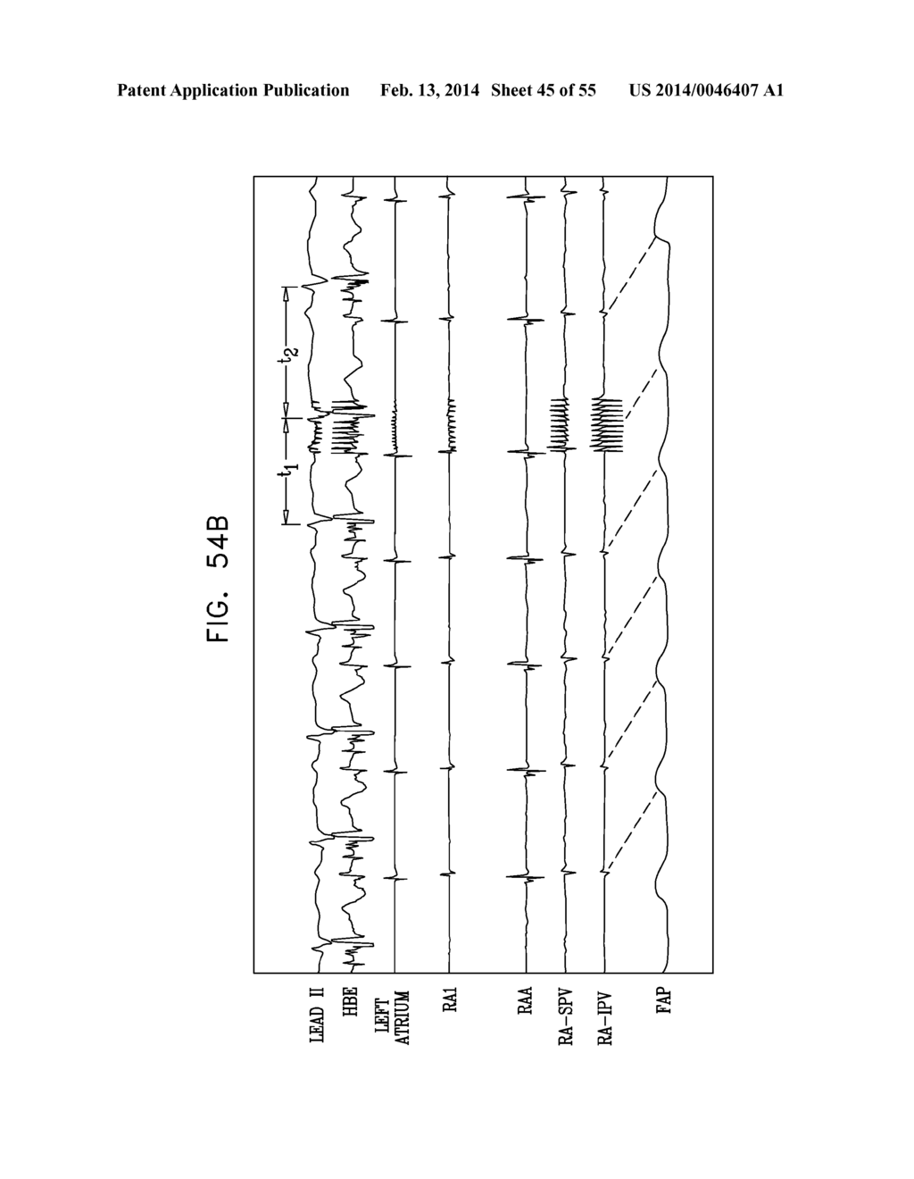 NERVE STIMULATION TECHNIQUES - diagram, schematic, and image 46