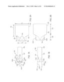 Heart Valve Prosthesis diagram and image