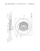 Heart Valve Prosthesis diagram and image