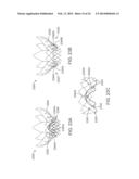 Heart Valve Prosthesis diagram and image