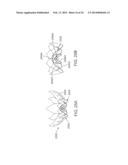 Heart Valve Prosthesis diagram and image