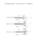 Heart Valve Prosthesis diagram and image