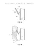 Devices and Methods for Limiting a Depth of Penetration for an Anchor     within an Anatomy diagram and image