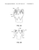 Devices and Methods for Limiting a Depth of Penetration for an Anchor     within an Anatomy diagram and image