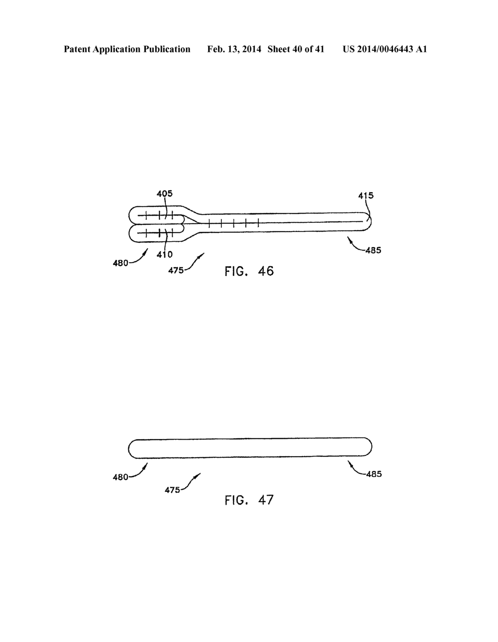 METHOD AND APPARATUS FOR FIXING A GRAFT IN A BONE TUNNEL - diagram, schematic, and image 41